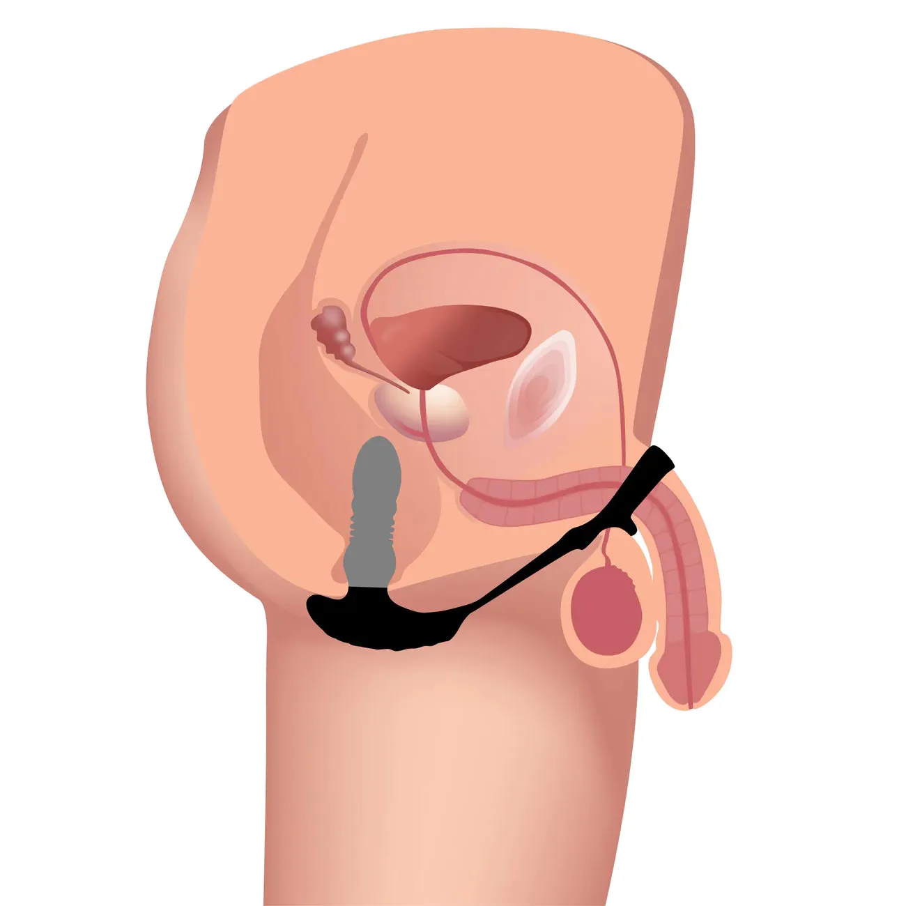 DEMON - App & Remote Control Thrusting Anal Vibrator Prostate Massager with Cock Ring 4.7 Inch